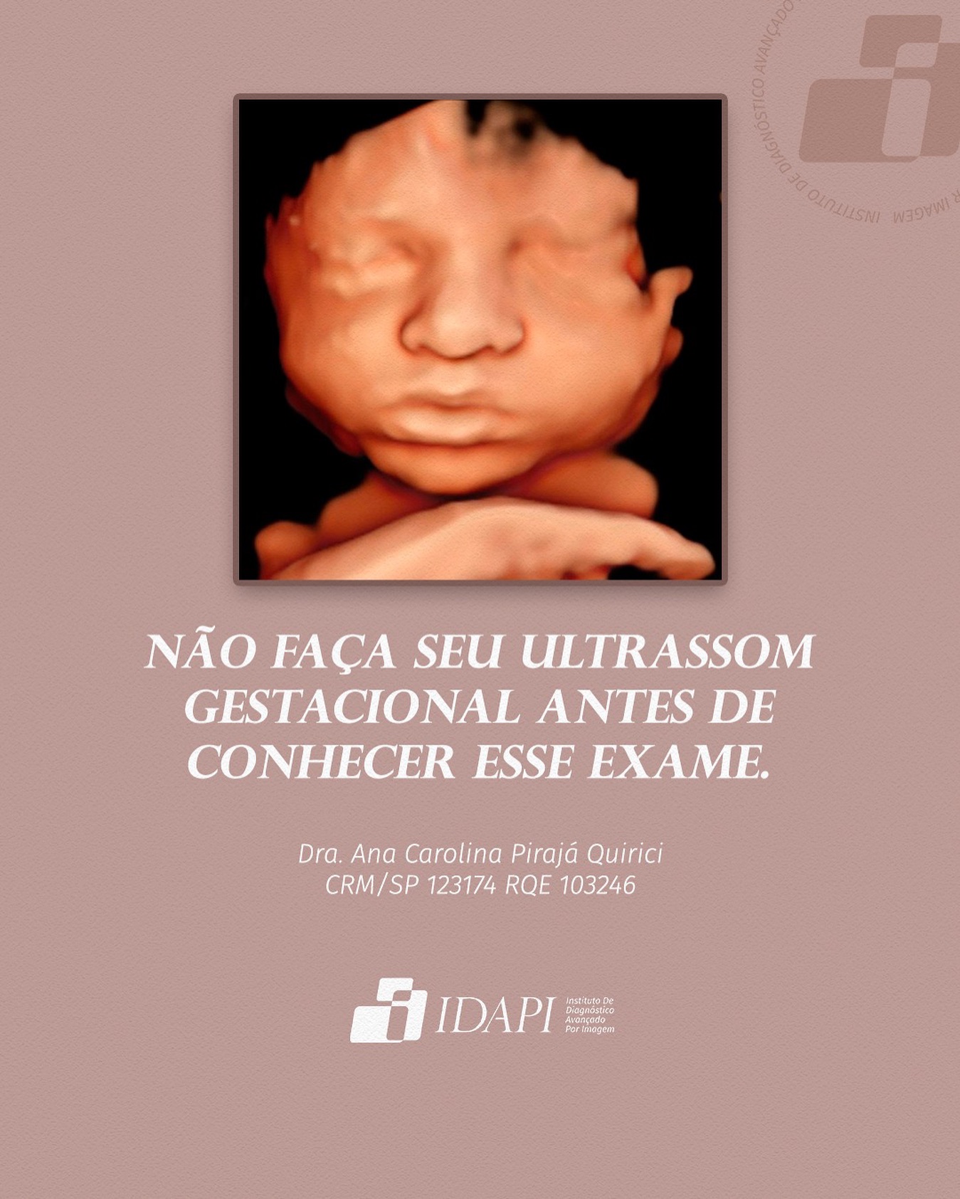 IDAPI - O Ultrassom 5D é um exame diferencial na gestação que oferece ...