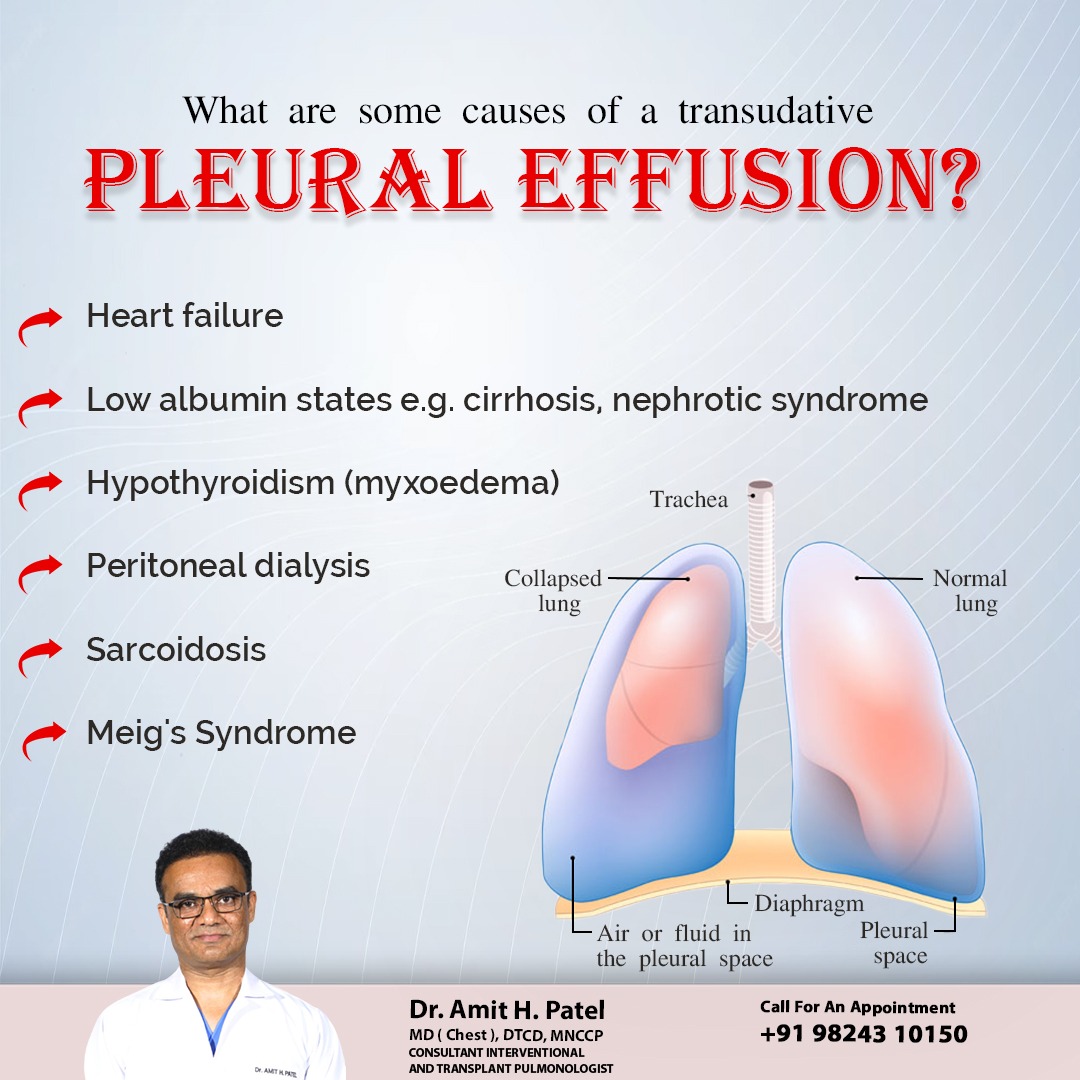 What’s causing your transudative... - Dr. Amit H. Patel | Facebook