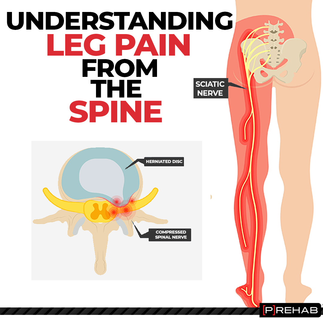 The Prehab Guys - CENTRALIZATION VERSUS PERIPHERALIZATION...