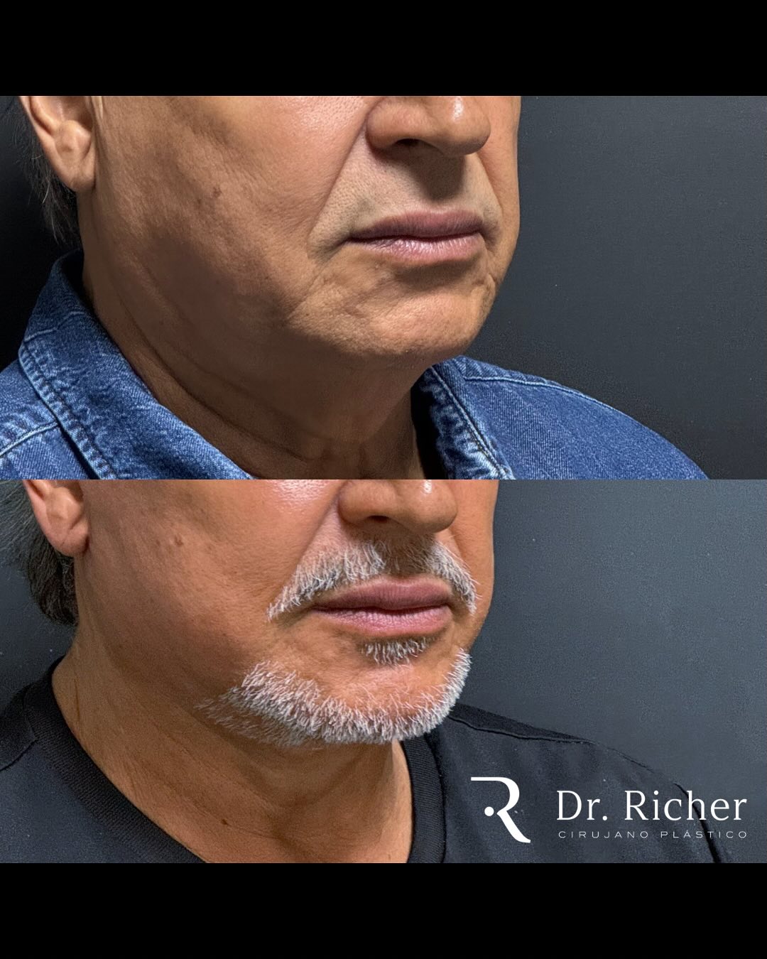 Dr. Richer Cirujano Plástico | San Pedro Garza Garcia