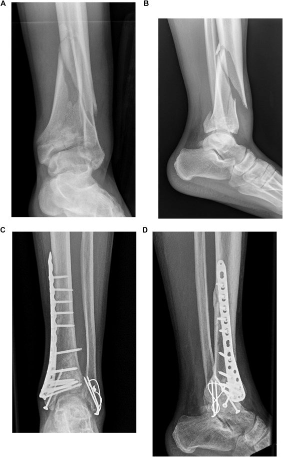 Foot Loading... - American College of Podiatric Medicine
