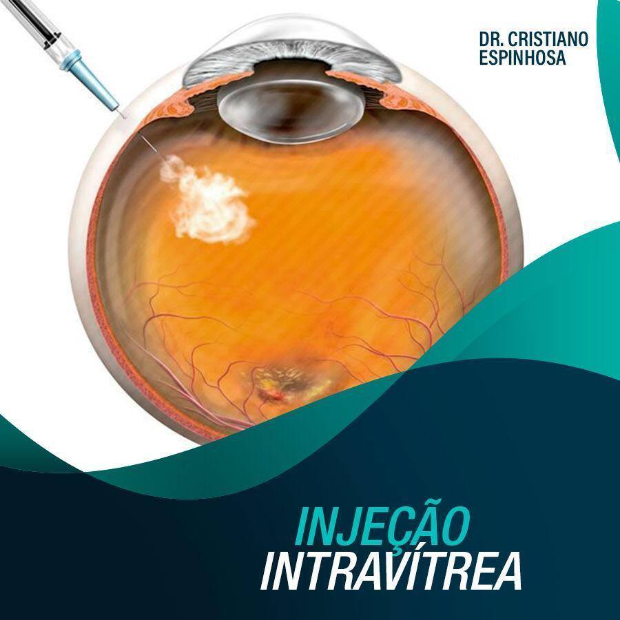 Centro - A injeção intravítrea ou intraocular é utilizada com bastante ...