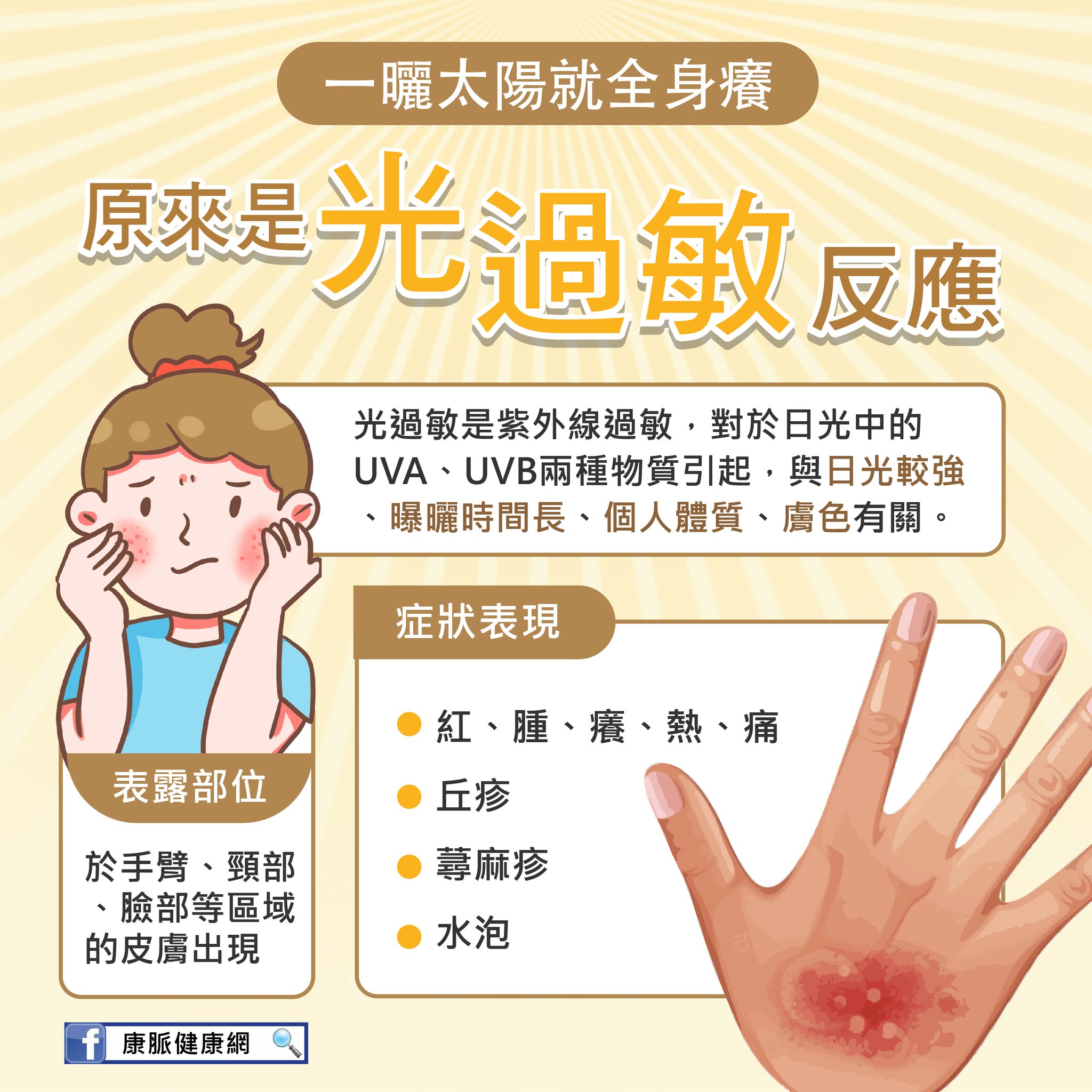 康脈健康網 - ☀️一曬太陽就全身癢 嚴重還會起水泡🫧 原來是 #光過敏 光過敏又稱為 #日光性皮膚炎... | Facebook