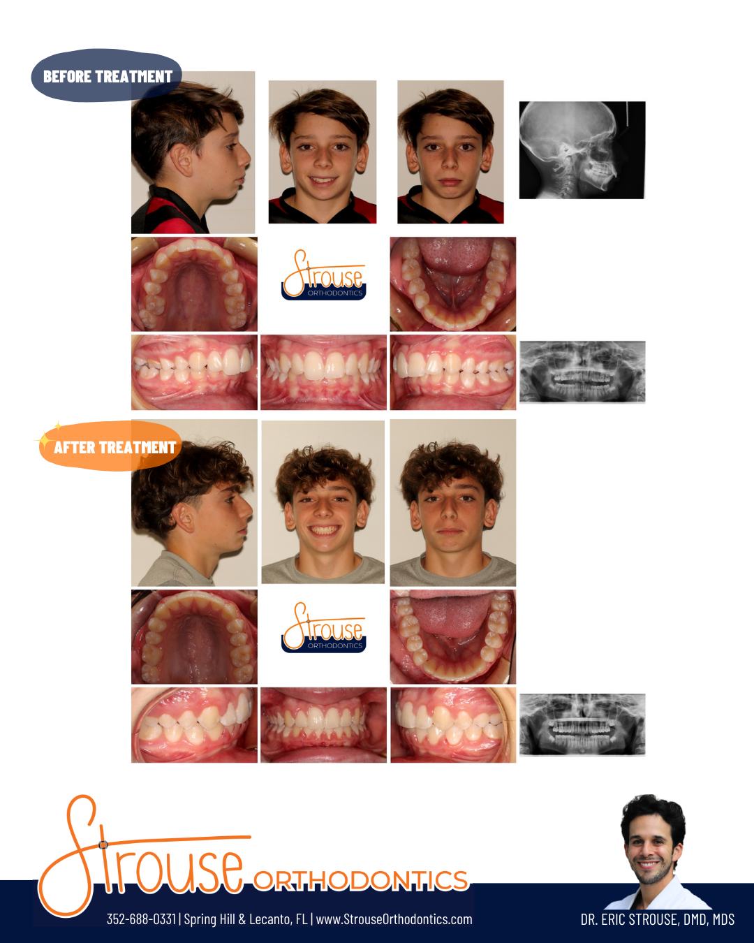 Strouse Orthodontics