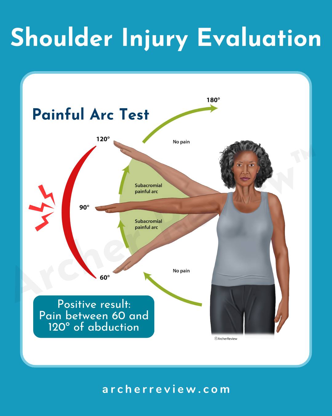 Painful Arc Test