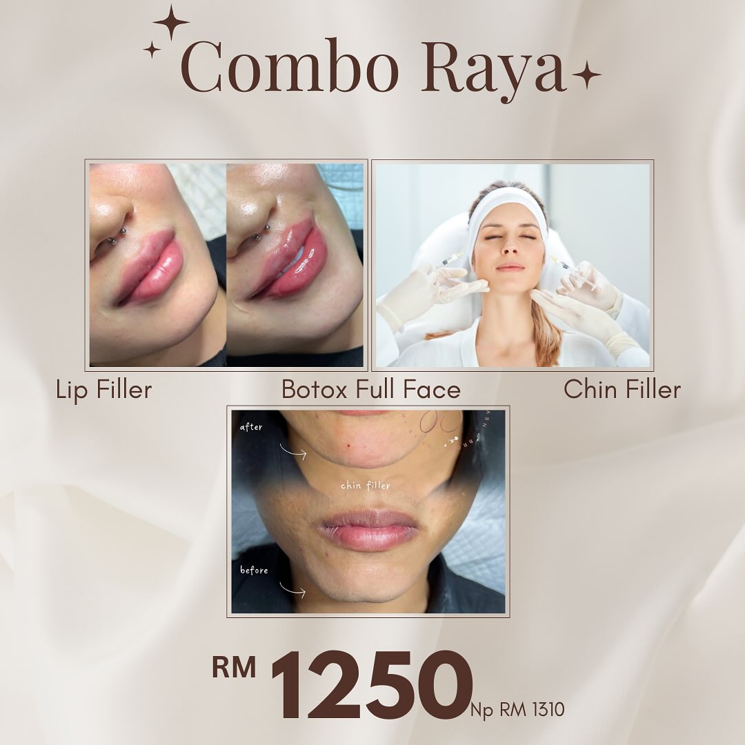 Dr.Aliy - COMBO RAYA 2025 Tahun ni Meriah Beraya sakan ? Nak cantik di ...