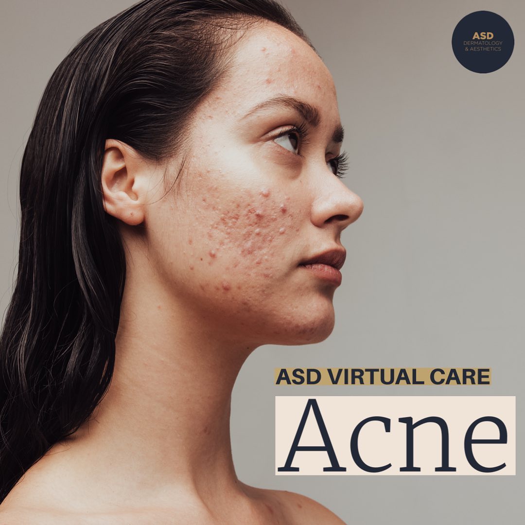 ASD - 🌟 We're excited to share that our dermatology clinic has ...
