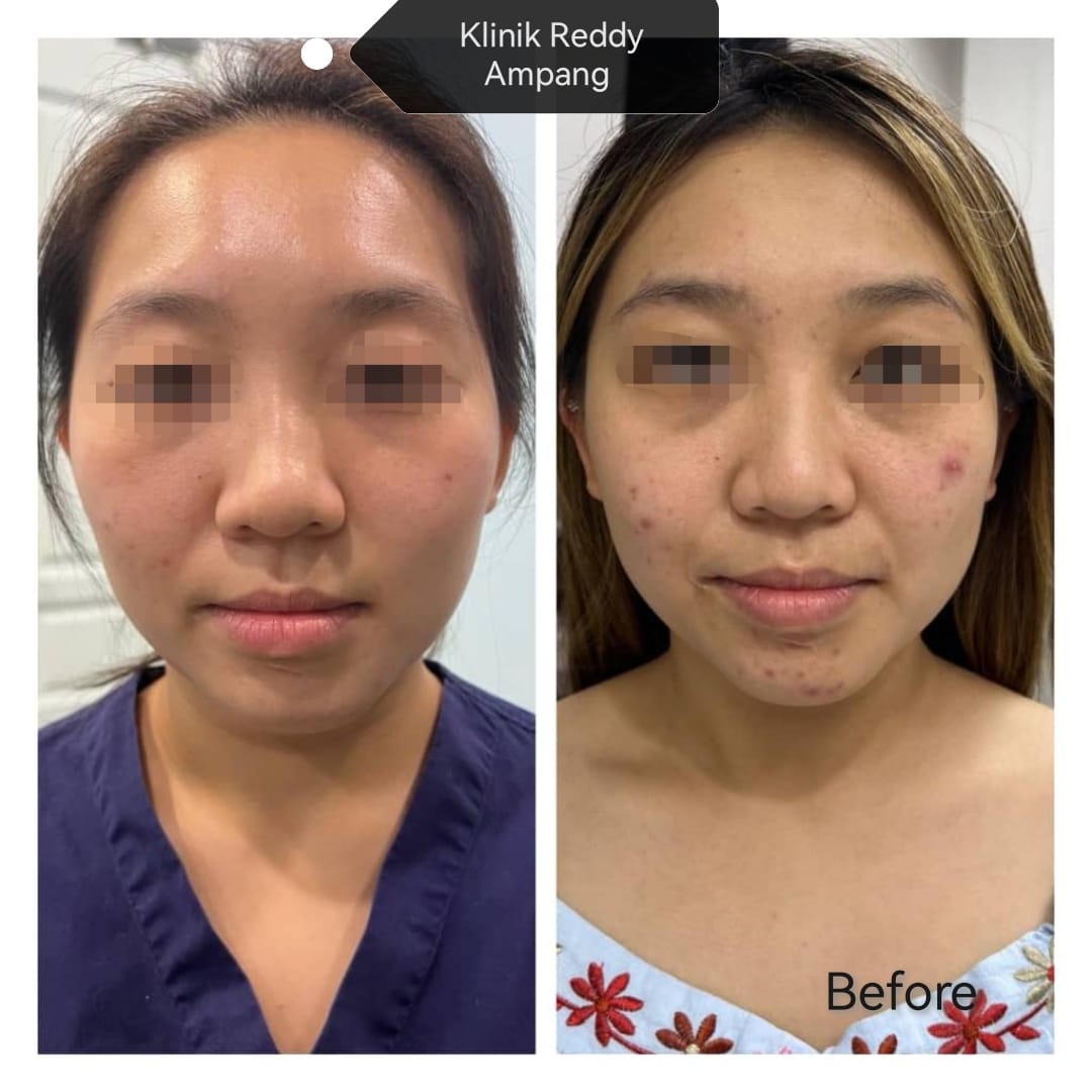 Klinik Reddy Ampang | Kuala Lumpur
