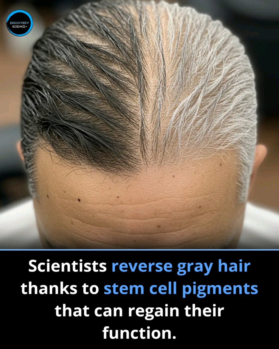 can glutathione reverse grey hair A Recent Study Finds That It May Be Possible To Gray كريم ضد التجاعيد المبكرة Biotech Peptides Alternatives: 5 Size:3 Bottles