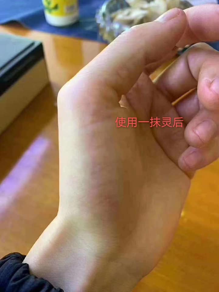 Chiudytan小铺 秋冬季手脱皮 干裂 痒 用一抹灵可以起到滋润 愈合 抑菌 效果如图 得意 Facebook