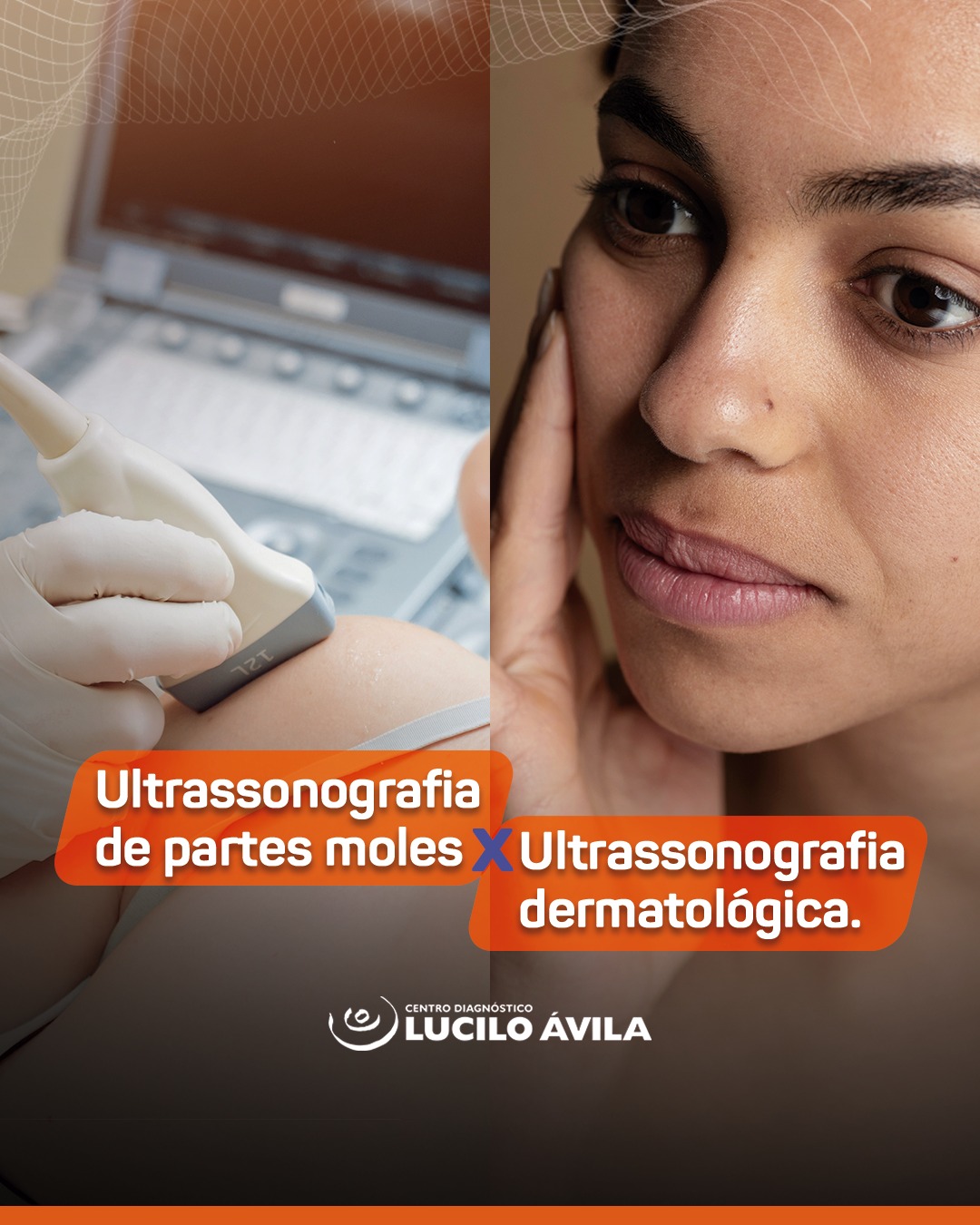 A ultrassonografia de... - Centro Diagnóstico Lucilo Ávila