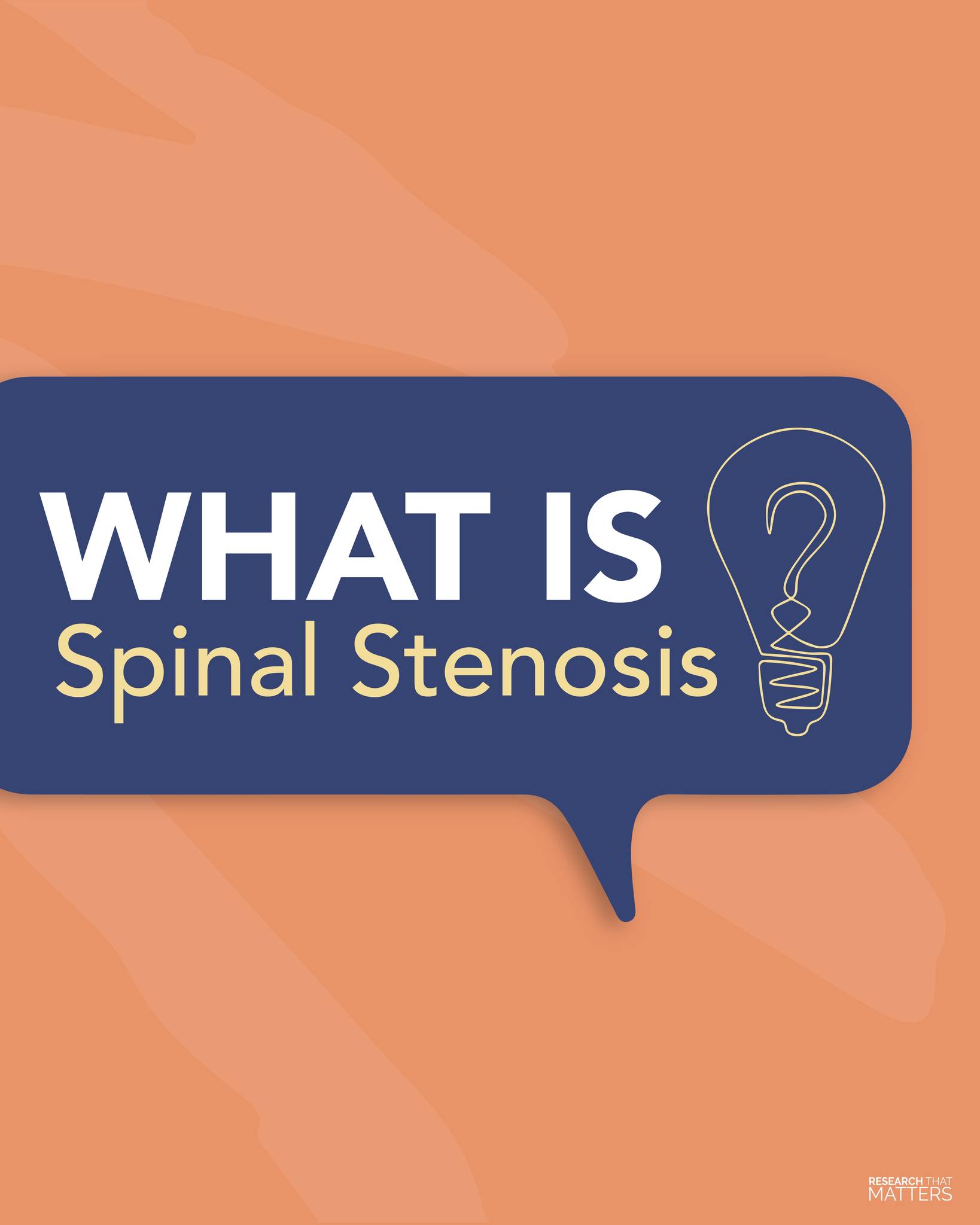 Dr. - Spinal stenosis is a narrowing of the spaces in your spine, which ...