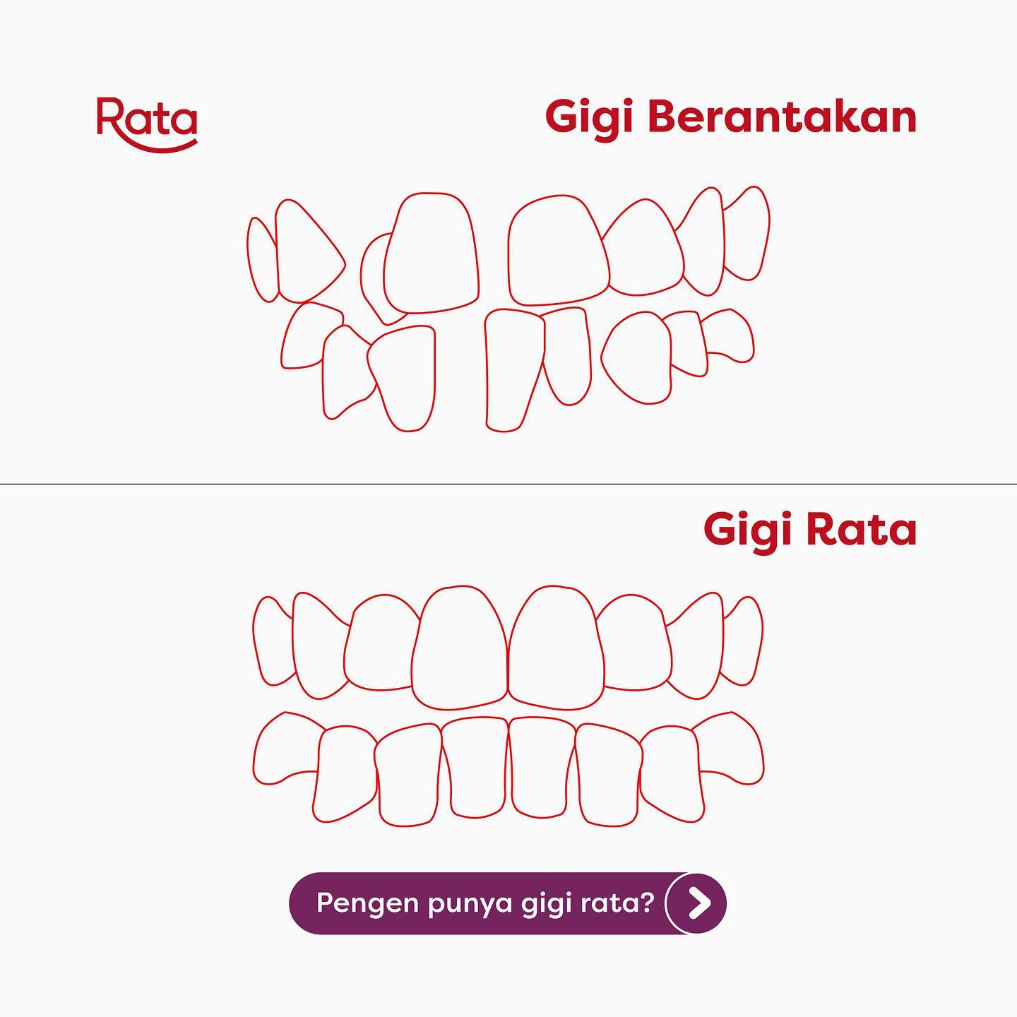 RATA - Tahu gak sih, gigi berantakan bisa menyebabkan... | Facebook