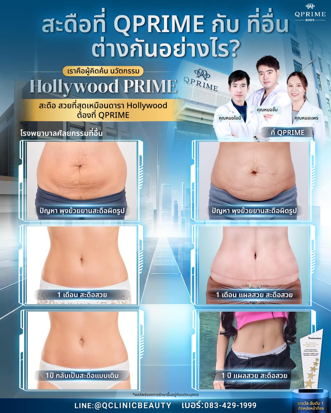เทียบกันชัดๆ ระหว่าง สะดือที่ QPRIME กับทีีอื่น ต่างกันอย่างไร ใครที่ ...
