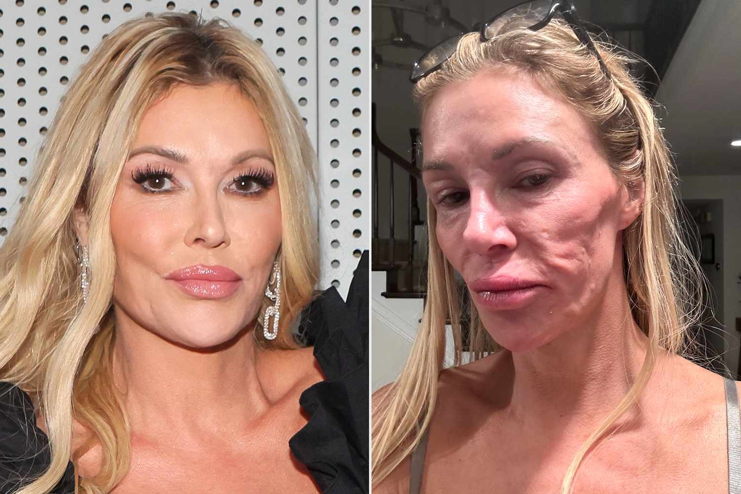 90Day Fiance Fans - Brandi Glanville Shares Her Face Is ‘Melting Away ...