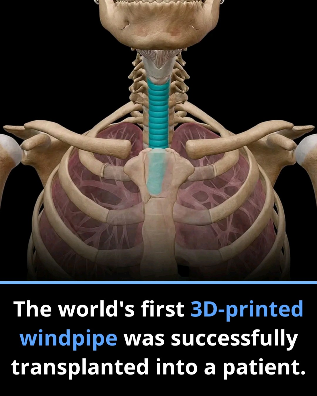 Neil deGrasse Tyson | 🫁 A woman just received a living 3D-printed ...