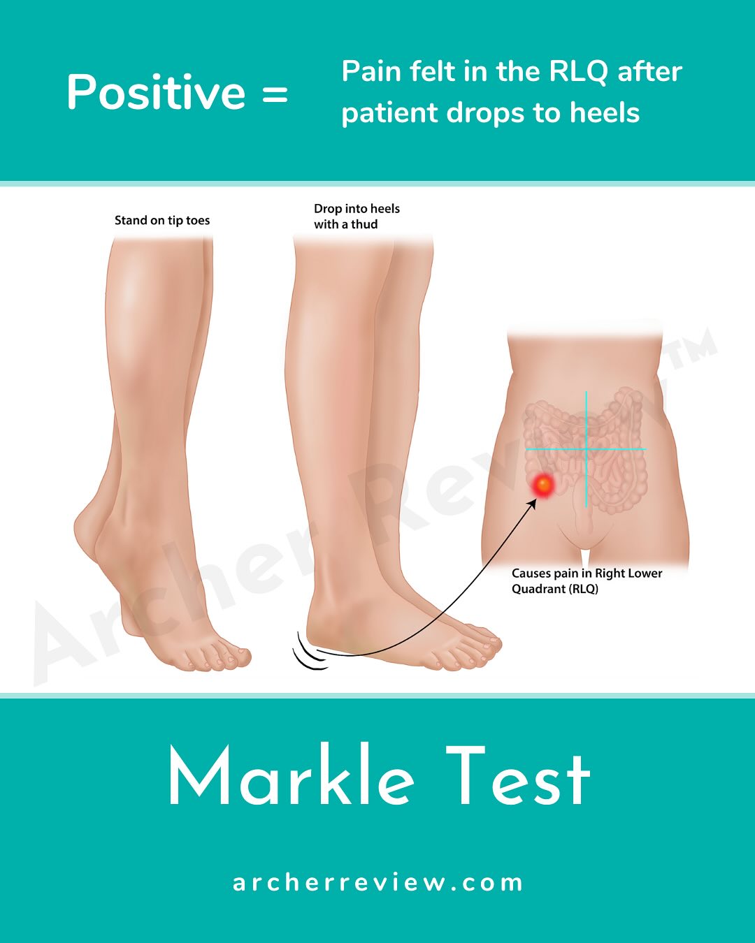 As a nurse... - Archer Nurse Practitioner Reviews | Facebook