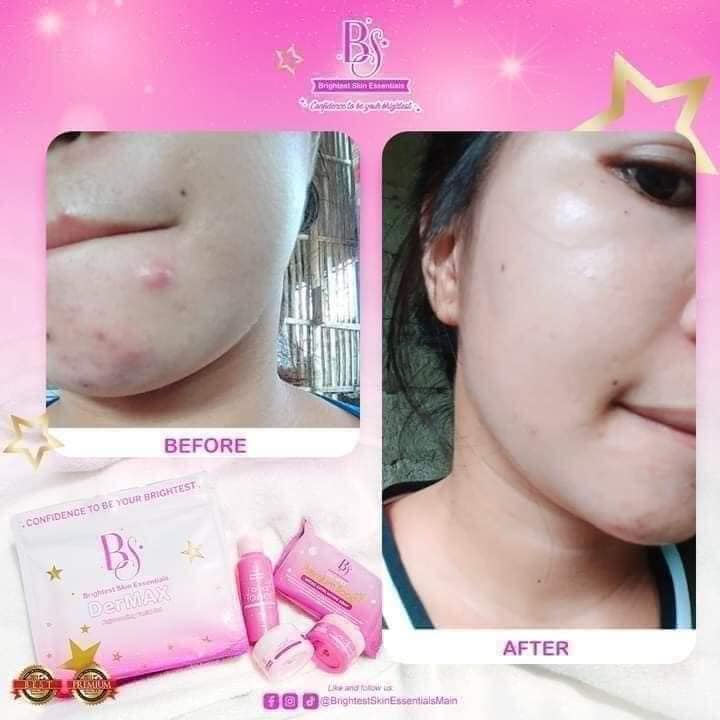 Crisel... - Crisel Wonder Beauty - District Distributor