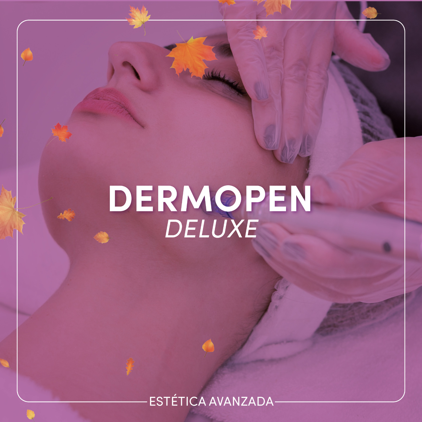 Centros Ideal - 🌟 ¡Descubre los beneficios del Dermopen! 🌟...