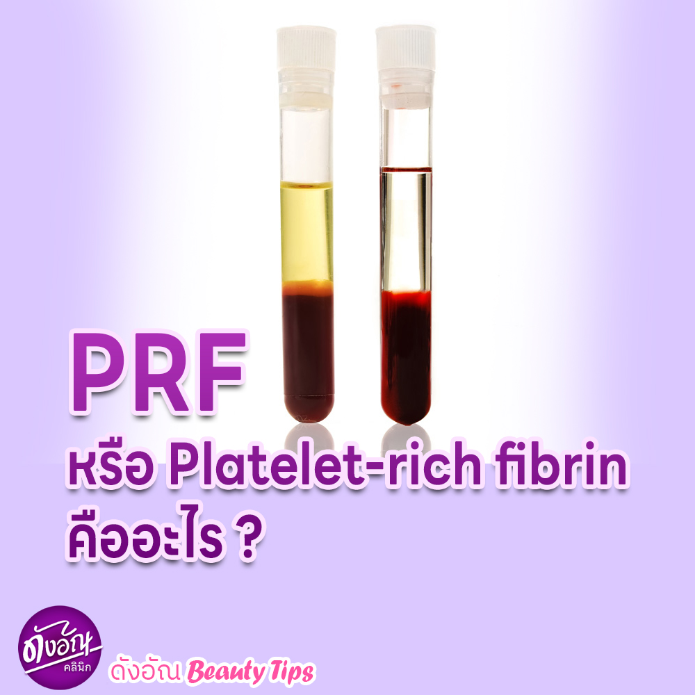ดังอัณ คลินิก - 💜แฟนเพจดังอัณคลินิกคงรู้จักการทำ PRP...