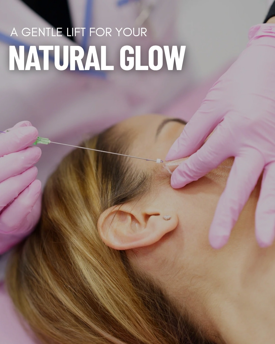 Ready for a subtle lift? ... - Opulence Aesthetic Clinic | Facebook