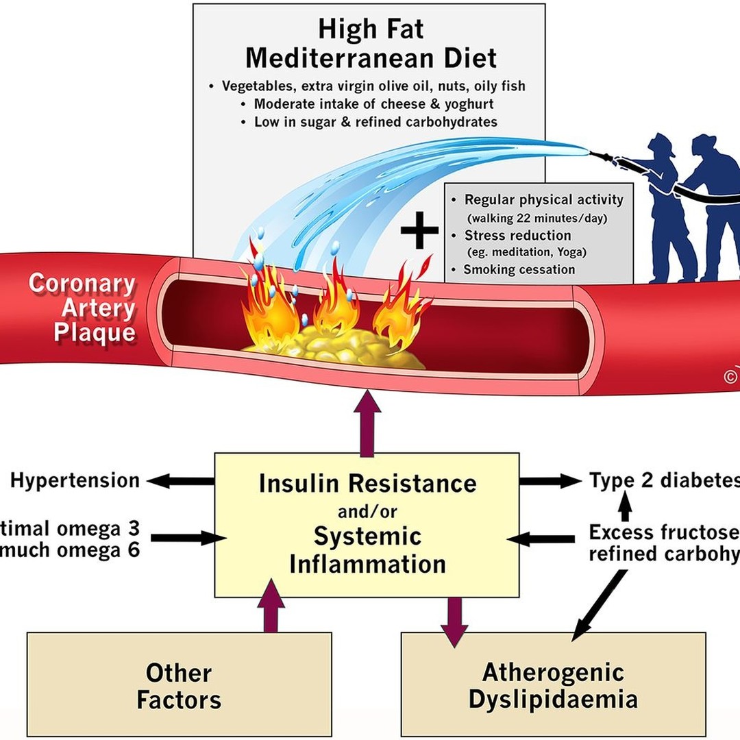 A graphic representation of the root... - Health Without Risk | Facebook