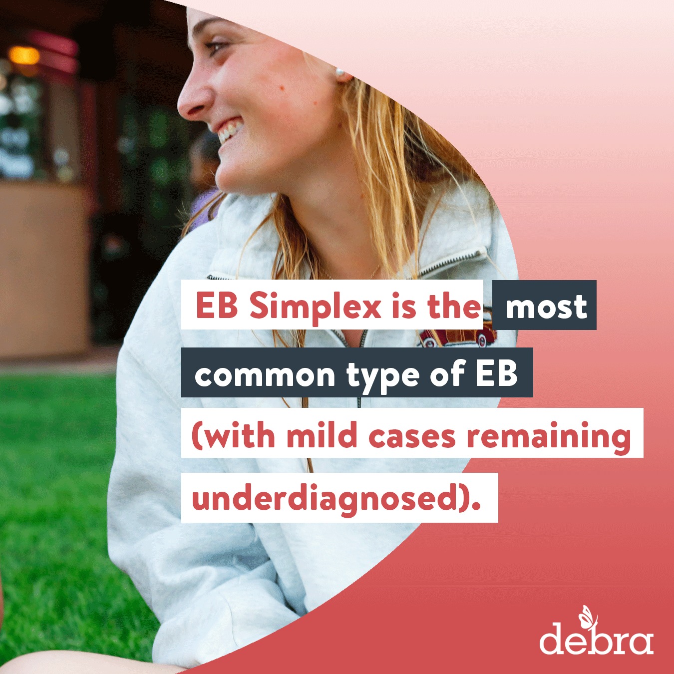 Epidermolysis Bullosa is a rare,... - debra of America