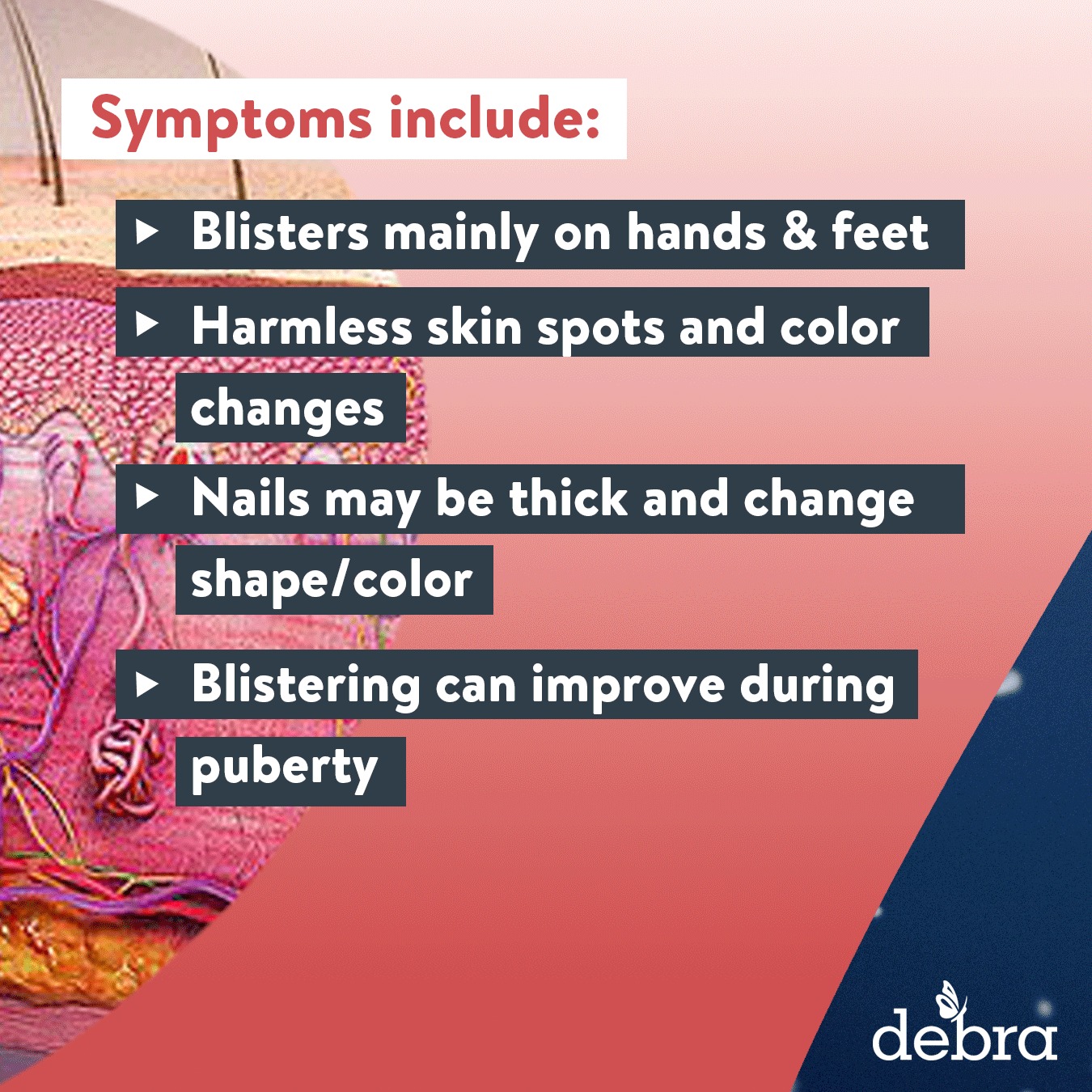 Epidermolysis Bullosa is a rare,... - debra of America