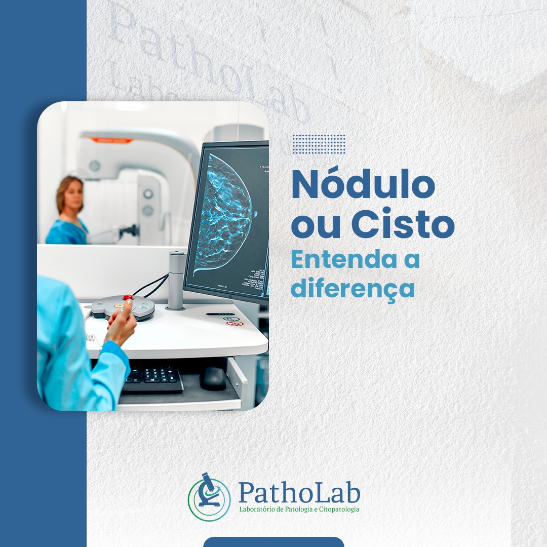 Cisto... - Laboratório PathoLab - Patologia e Citopatologia | Facebook