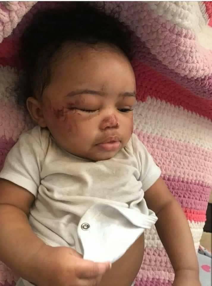 Info Web Un Bebe Maltraite Faites Attention Aux Nounous Facebook