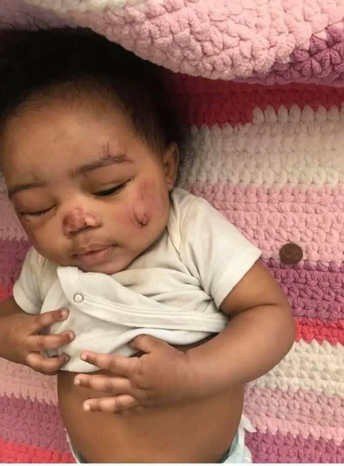 Info Web Un Bebe Maltraite Faites Attention Aux Nounous Facebook