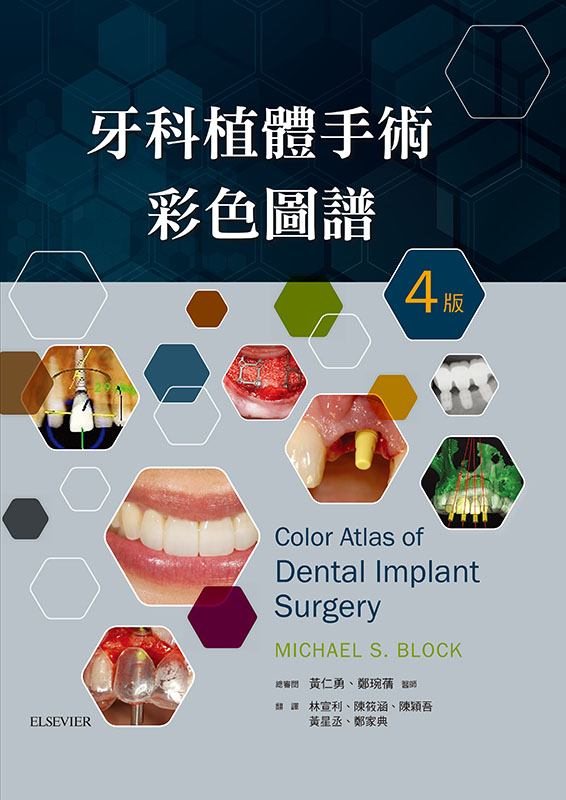 Elsevier醫學資訊站 - Color Atlas of Dental Implant Surgery... | Facebook