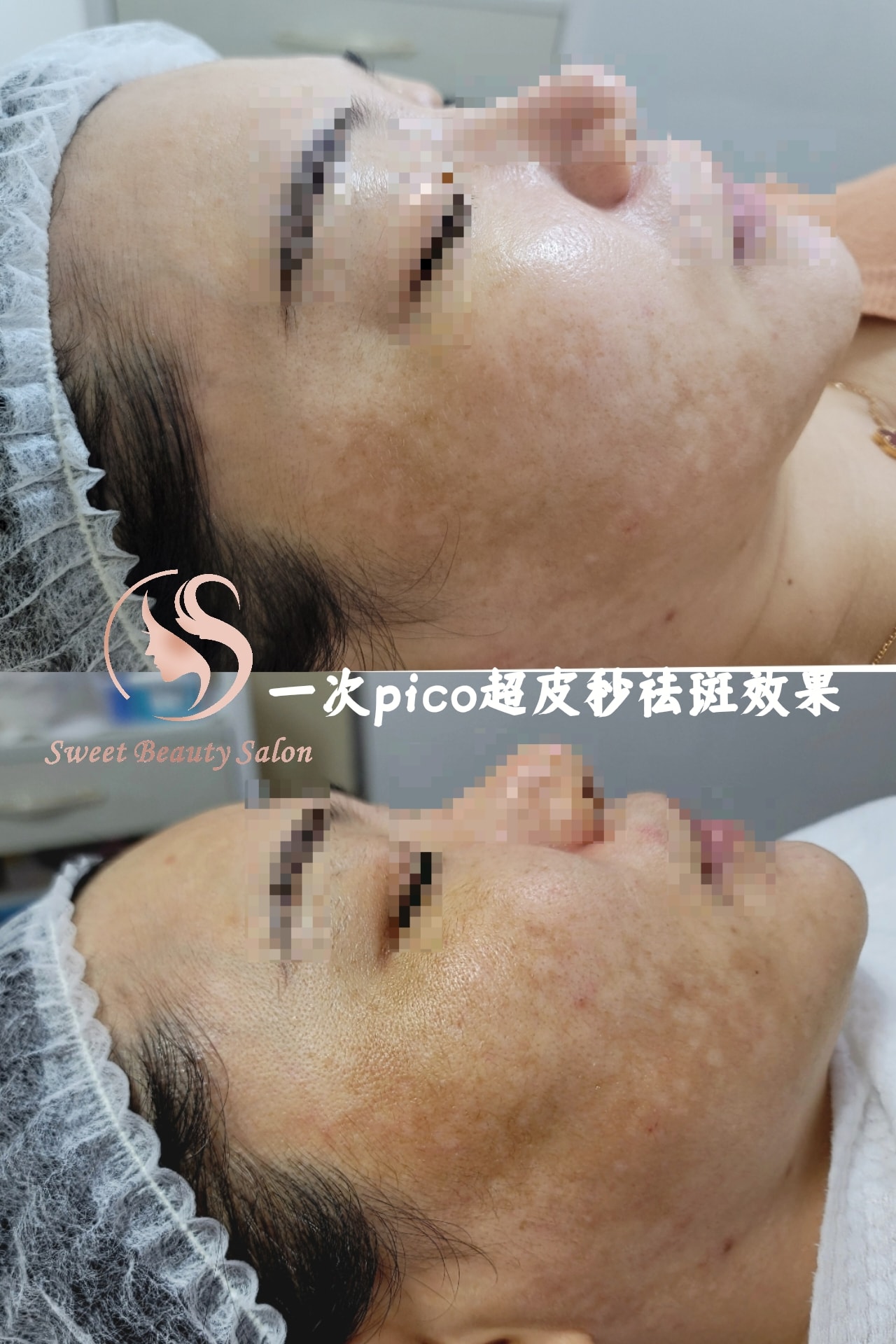 Sweet Beauty Salon HK | Kowloon