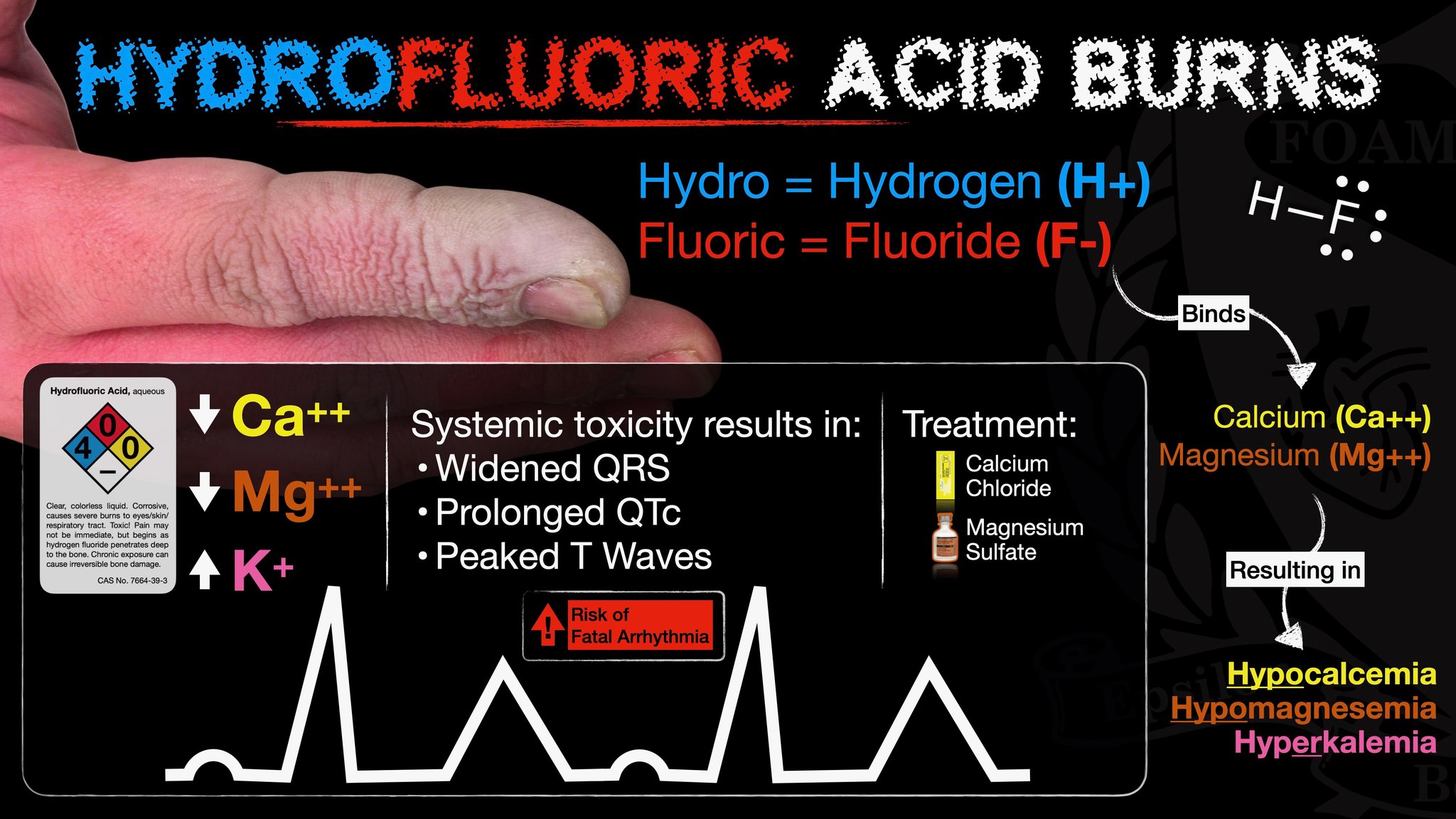 FOAMfrat - 🚨 Hydrofluoric Acid Burns 🚨 Hydrofluoric acid (HF) burns can ...