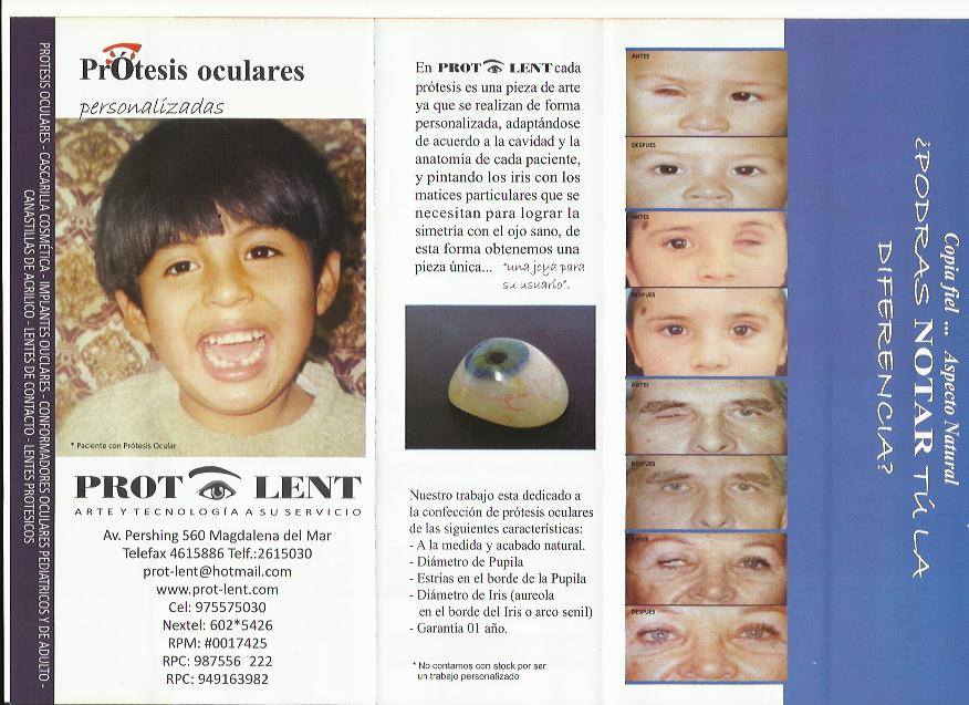 Prot-Lent - Protesis Oculares | Lima