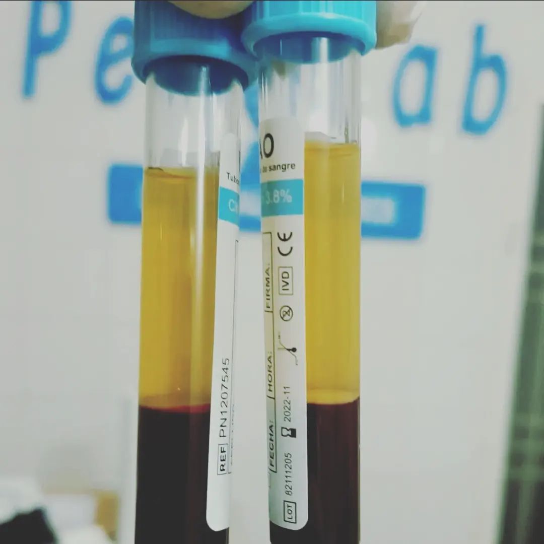 PerLab - El Plasma Rico en Plaquetas que beneficios... | Facebook
