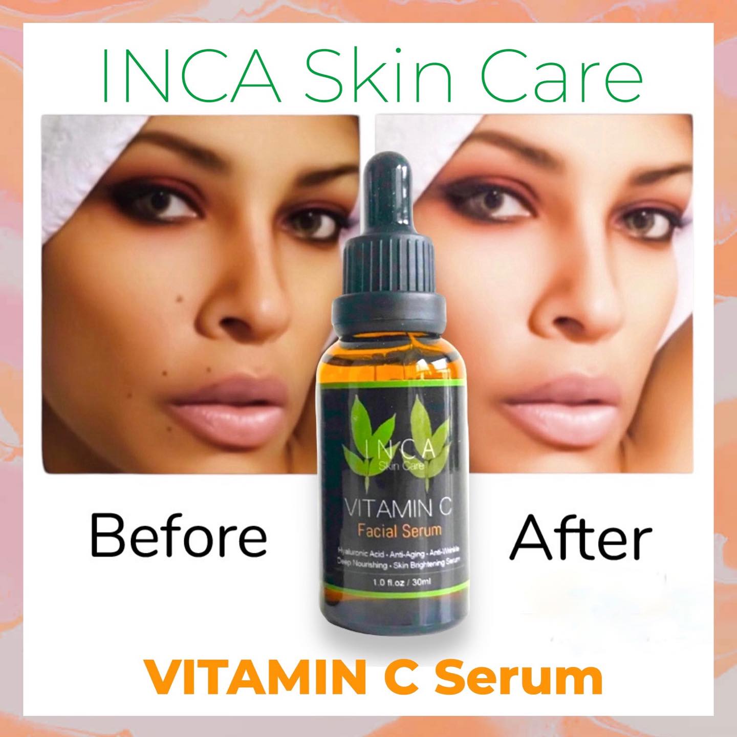 INCA Skin Care | Los Angeles CA