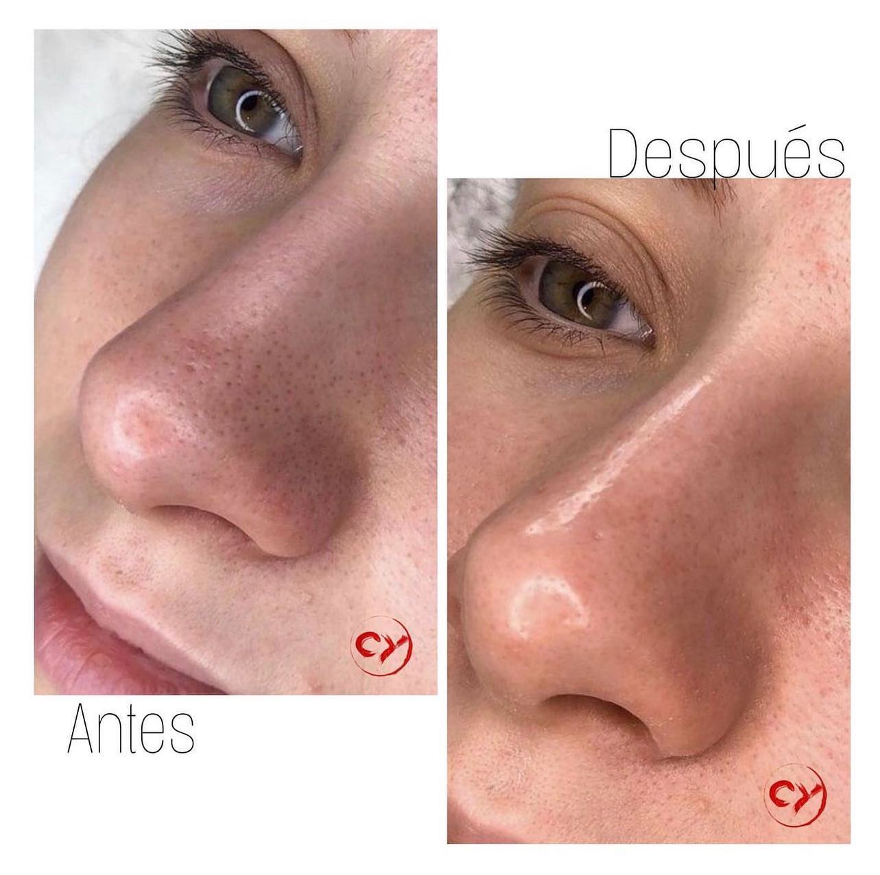 El Antes y después... - Costy Yabes Make up & Skincare Studio