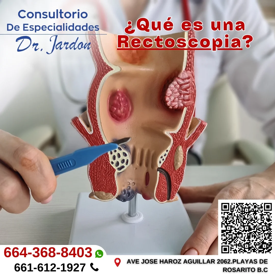 Consultorio - ¿Sabes qué es una rectoscopia? 🧐 Es un estudio médico que ...