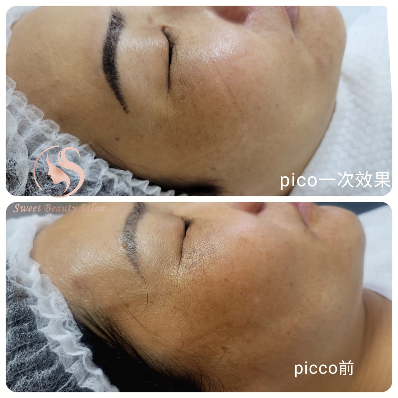 Sweet Beauty Salon HK | Kowloon