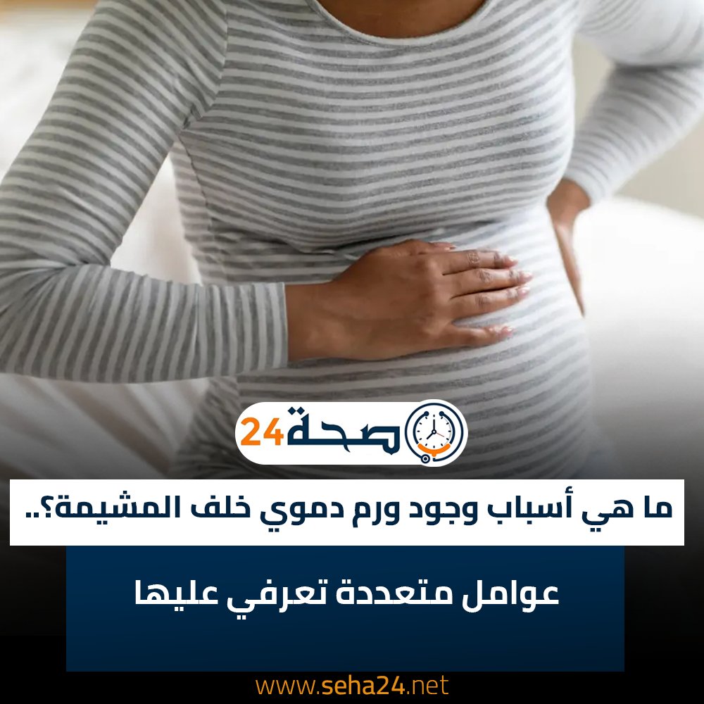 صحة - ما هي أسباب وجود ورم دموي خلف المشيمة؟.. عوامل متعددة تعرفي عليها ...