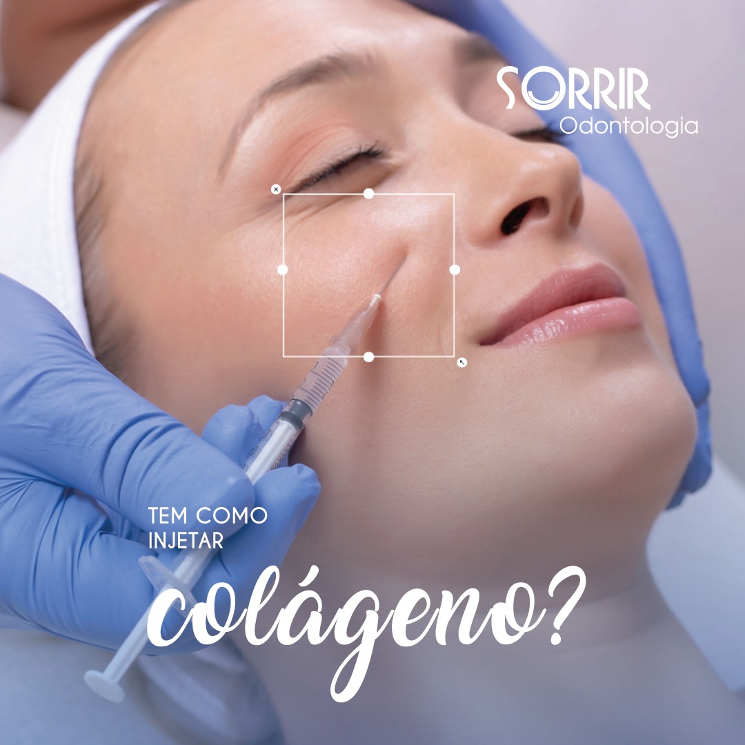 Sorrir - Tem como injetar colágeno? O colágeno é essencial para ...
