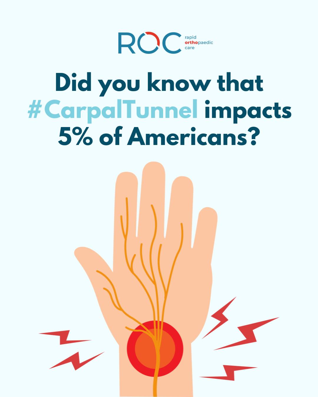 ROC - Carpal tunnel syndrome (CTS) is a common condition that occurs ...