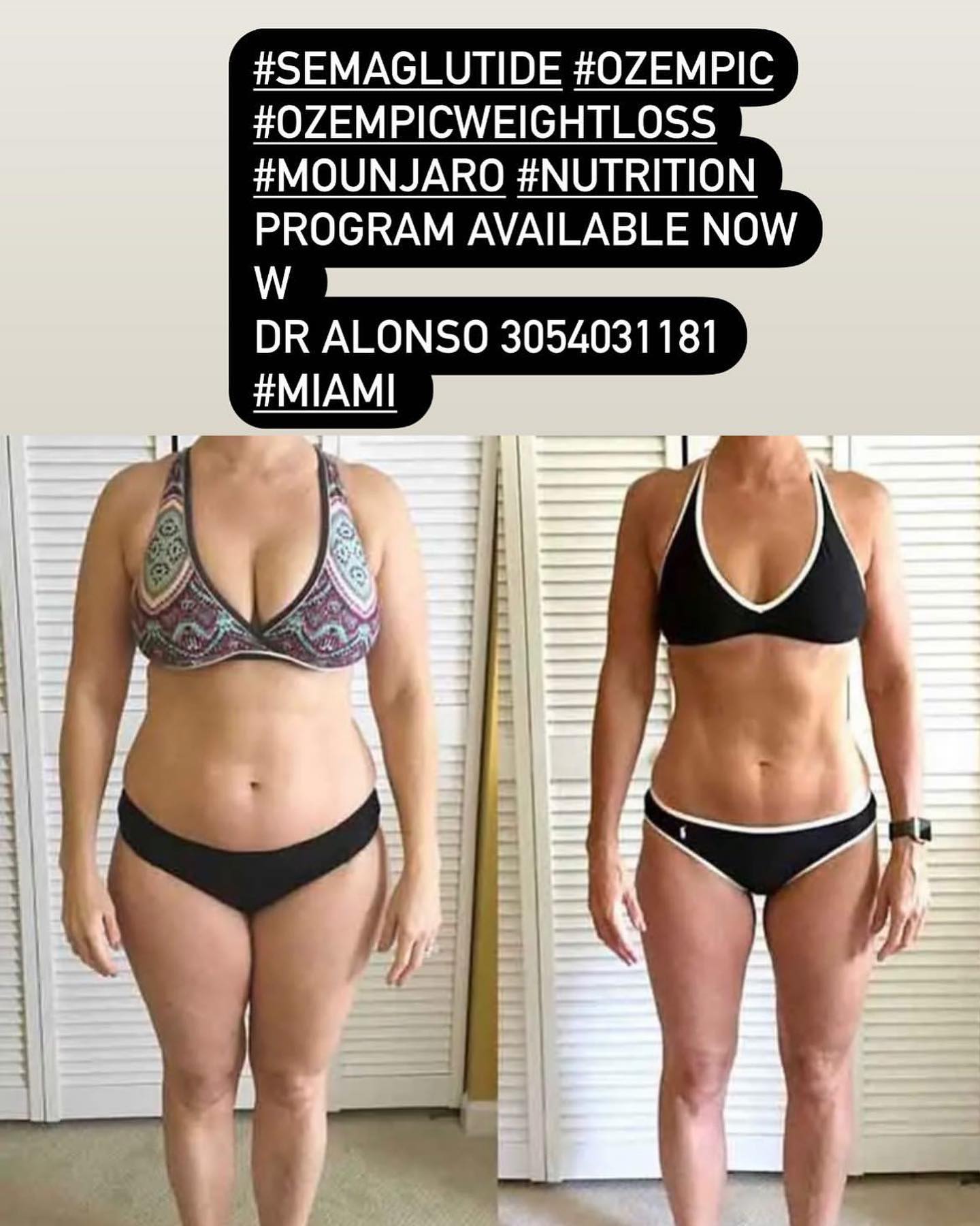 semaglutide fertility reddit LINK IN COMMENTS: People taking GLP-1 drugs may find themselves part of an unexpected baby boom, with experts noting the popular weight-loss drugs can affect medications and By Concern_Loss of Firmness Here's How to Know Choose your 60 serving PerfectAmino:Powder / Chocolate
