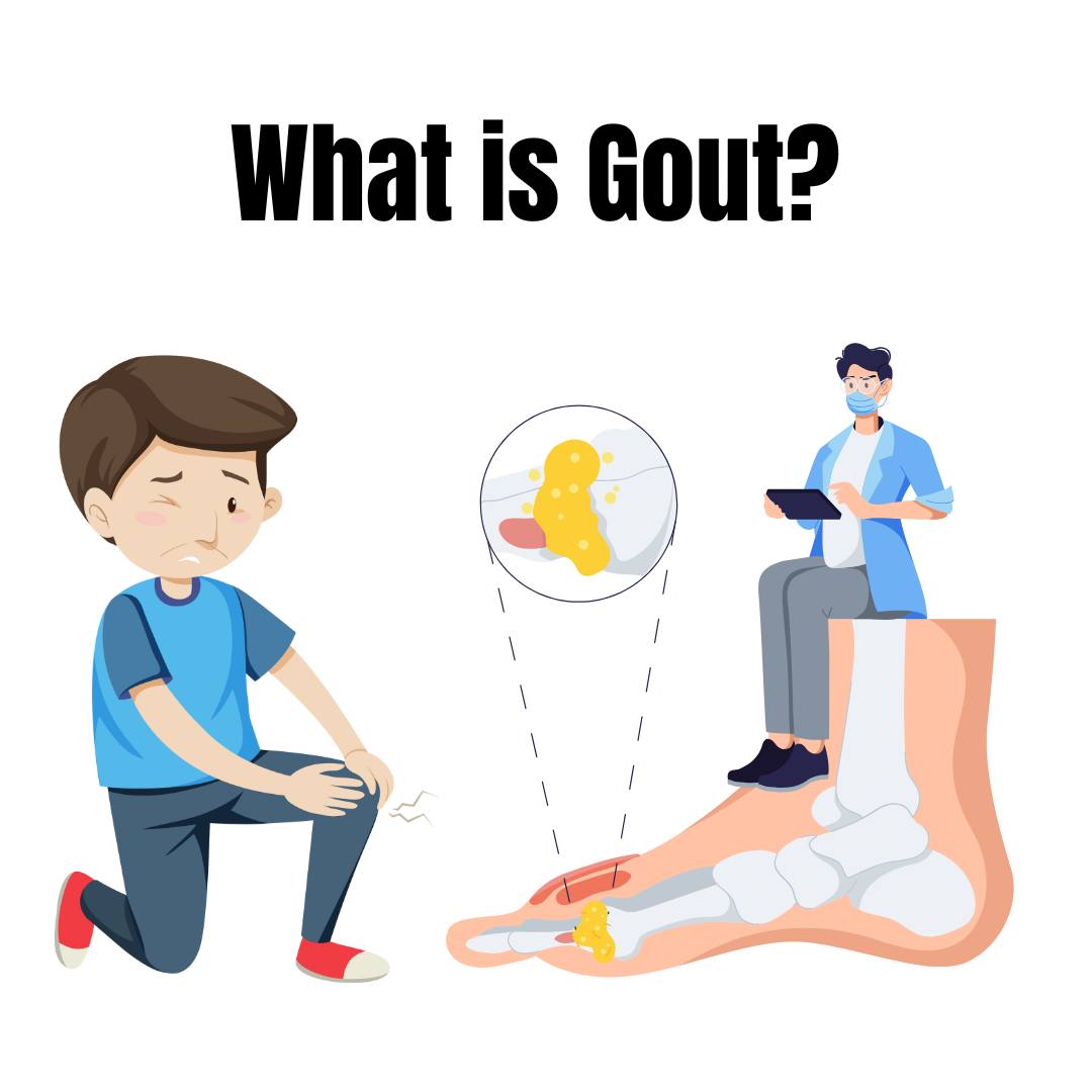 does glutathione help with gout 6 health benefits of Glutathione Benefits for Gut Health