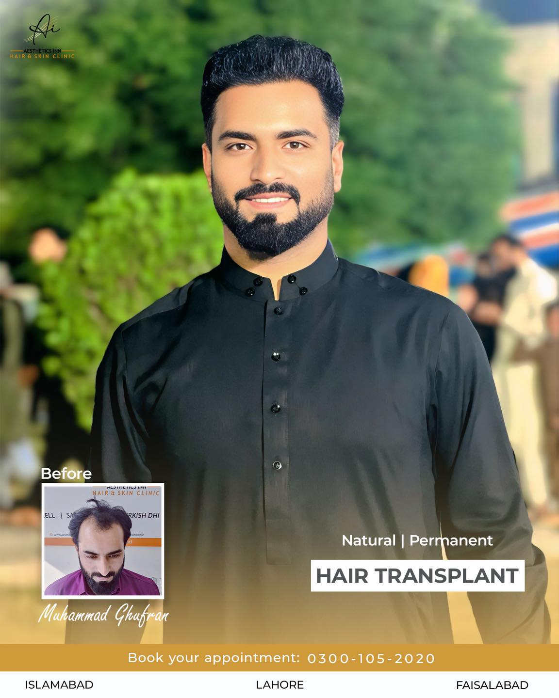 Aesthetics - Witness the remarkable transformation of Muhammad Ghufran ...