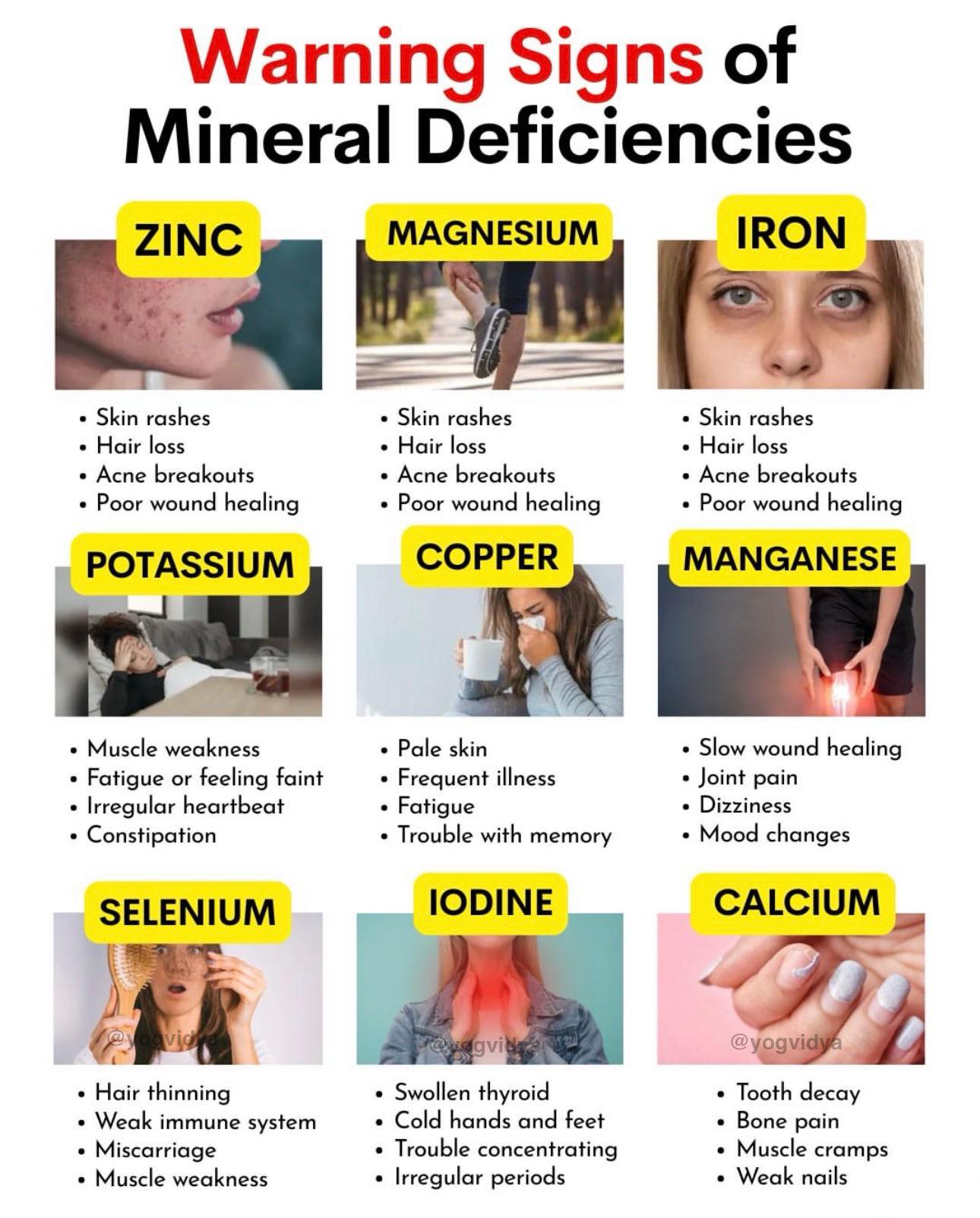 Yogvidya - Warning Signs of Mineral Deficiencies Yogvidya #vitaminboost ...
