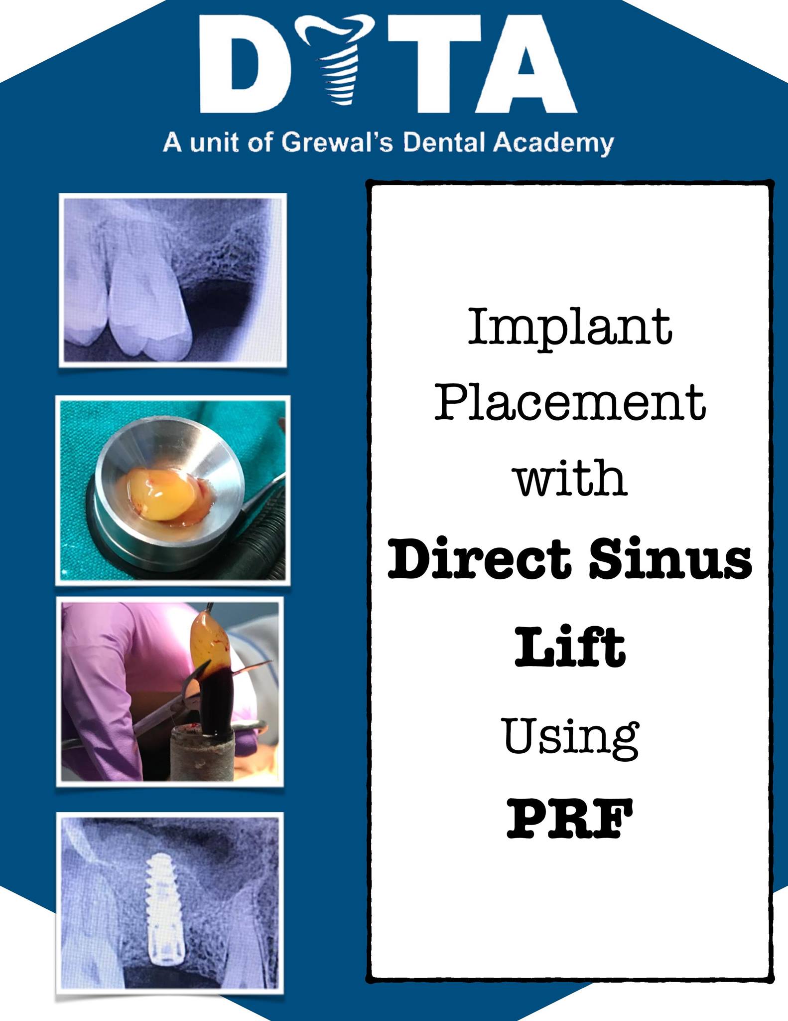 Dr. Raj Kamal Grewal - Take care of your teeth and they will take care ...