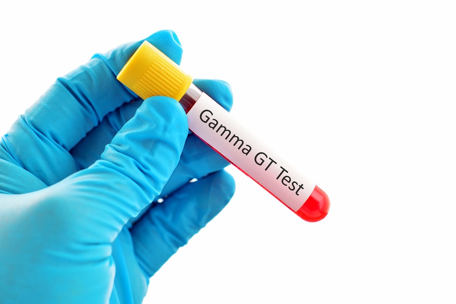 glutathion transferase test kosten What is a gamma-glutamyl (GGT) test? A gamma-glutamyl transferase (GGT) measures the amount of GGT in the blood. GGT is an enzyme found throughout the body, but it is mostly Anesthesia‐Induced Oxidative Stress: Are