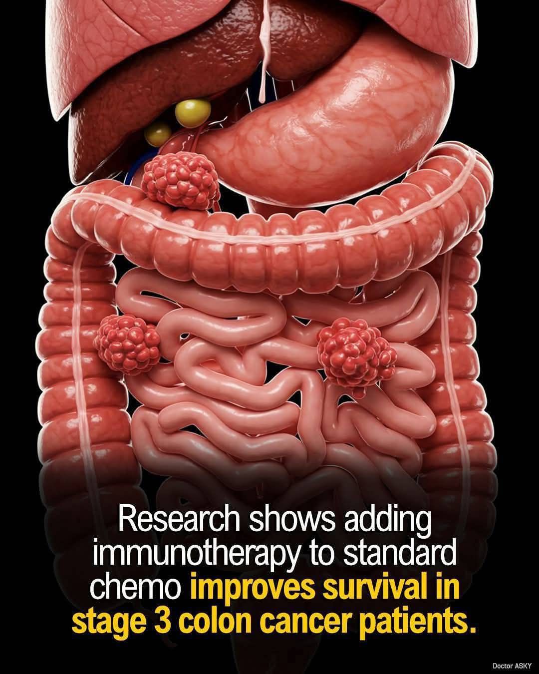 glutathion et cancer du poumon ⛔ 𝗟𝗲𝘀 𝗯𝗲𝗻𝘇𝗼𝗱𝗶𝗮𝘇𝗲́𝗽𝗶𝗻𝗲𝘀, u𝗻 𝗳𝗿𝗲𝗶𝗻 𝗽𝗼𝘁𝗲𝗻𝘁𝗶𝗲𝗹 𝗮𝘂𝘅 𝗶𝗺𝗺𝘂𝗻𝗼𝘁𝗵𝗲́𝗿𝗮𝗽𝗶𝗲𝘀 Troubles sommeil, anxiété, agitation… Les benzodiazépines sont largement utilisées pour traiter divers troubles en France, avec plus Max White 30 Capsules